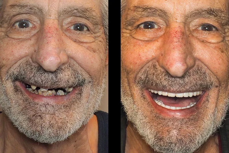Before After Image
